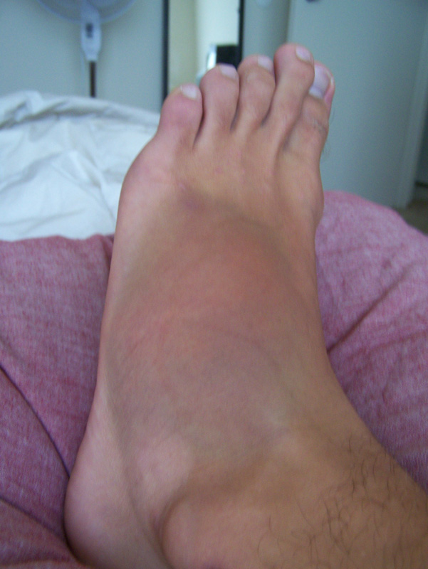 foot2.jpg